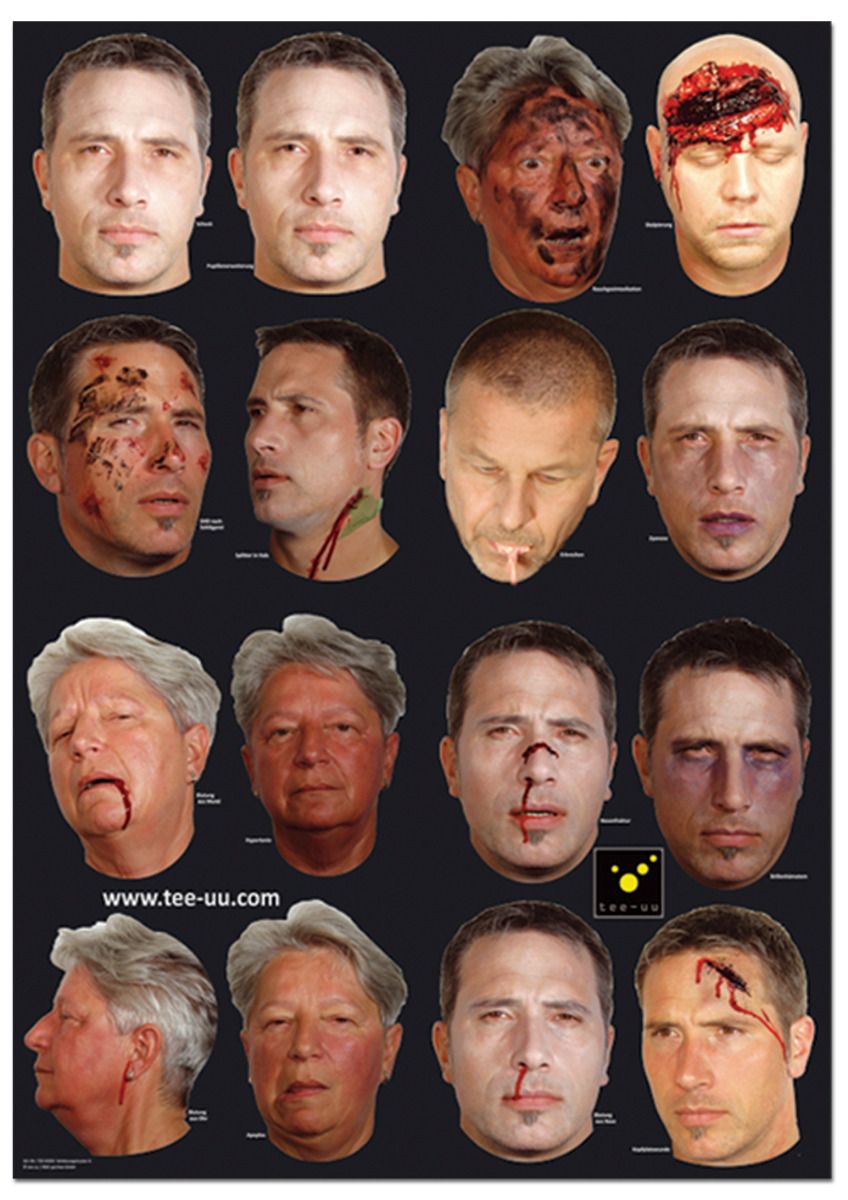 tee-uu_1121-0000_verletzungsmuster_poster_a_k_pfe TEE-UU Verletzungsmuster-Set für Übungspuppe CRASH & CARRY