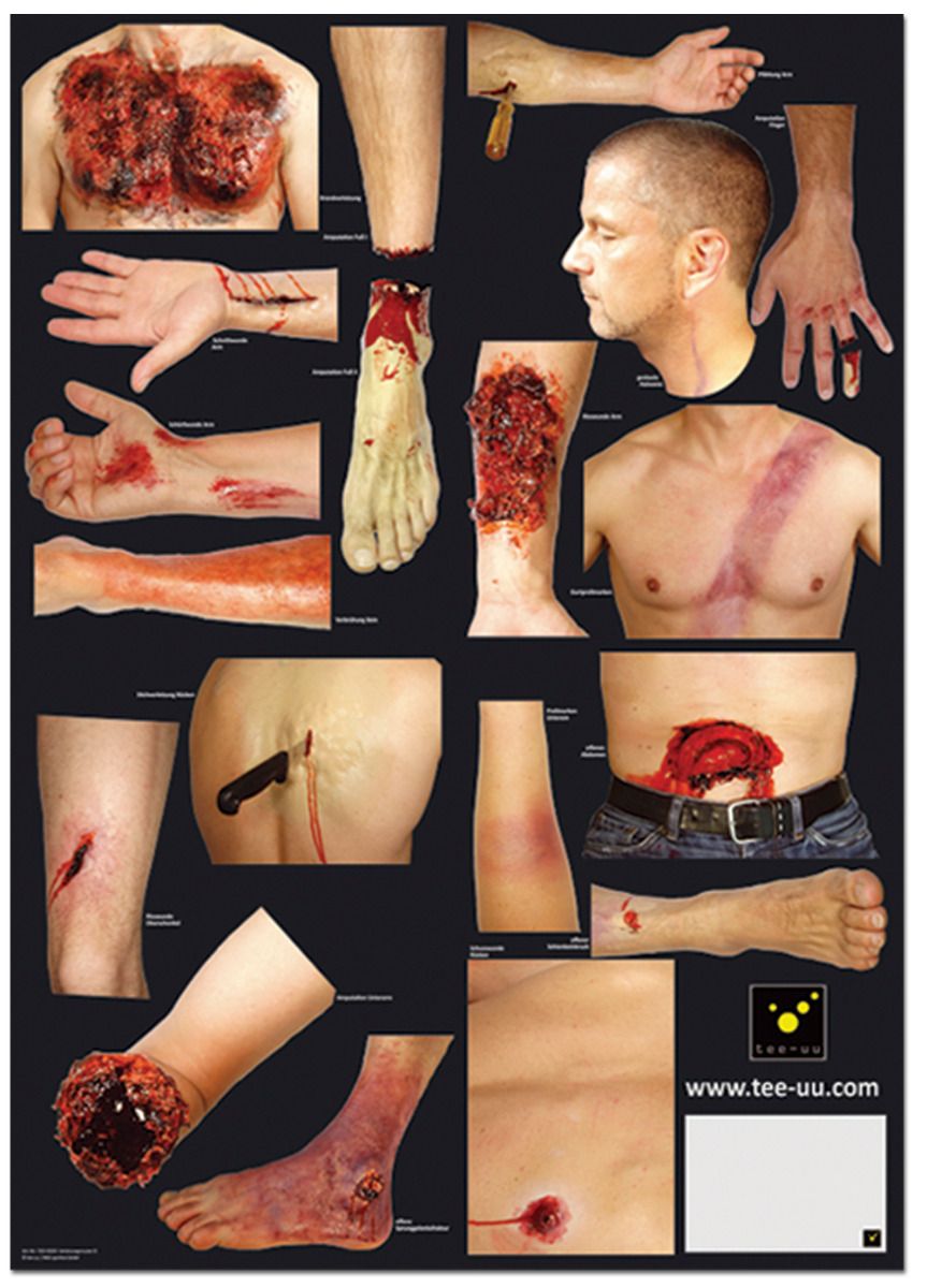 Verletzungsmuster-Set für Übungspuppe CRASH & CARRY