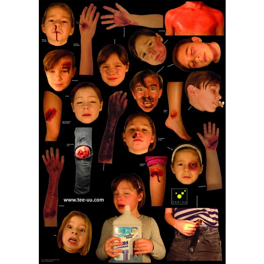 tee-uu_1122-0000_verletzungsmuster_junior5d629d2138502 Verletzungsmuster für CRASH JUNIOR